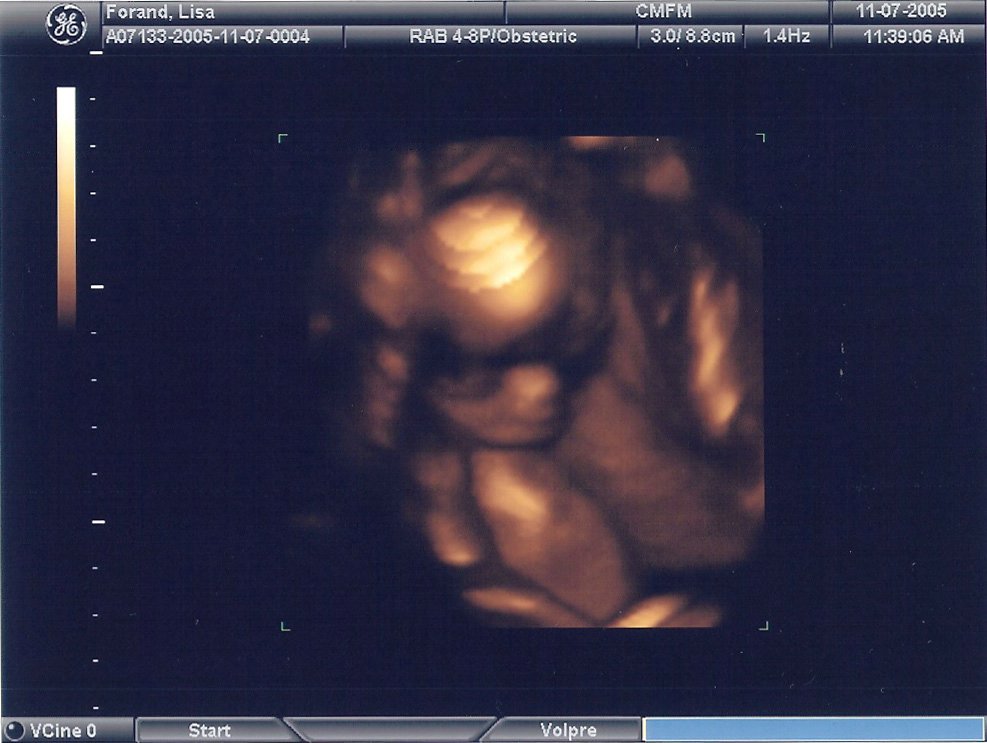 21-week sonogram 1.jpg