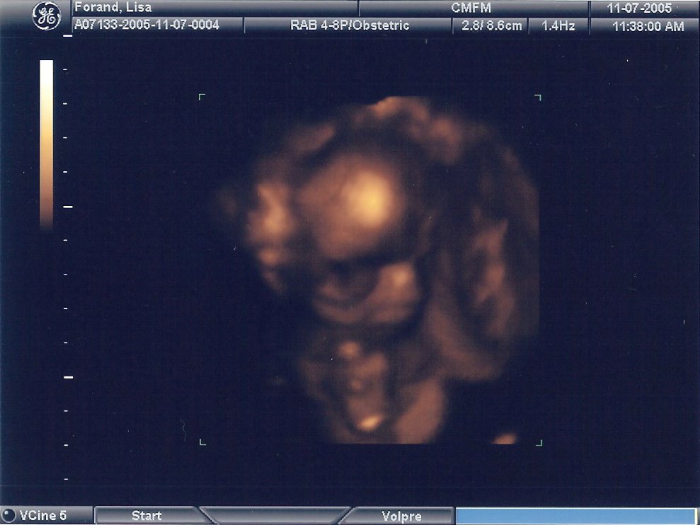 21-week sonogram 3.jpg