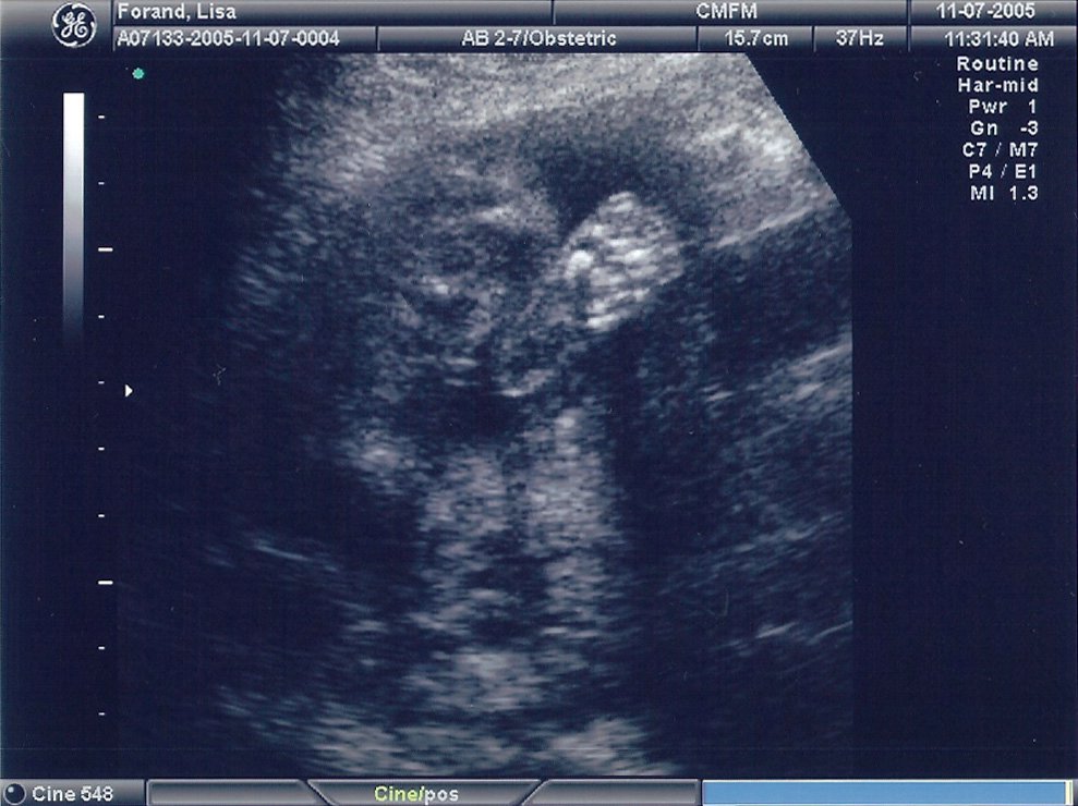 21-week sonogram 4.jpg