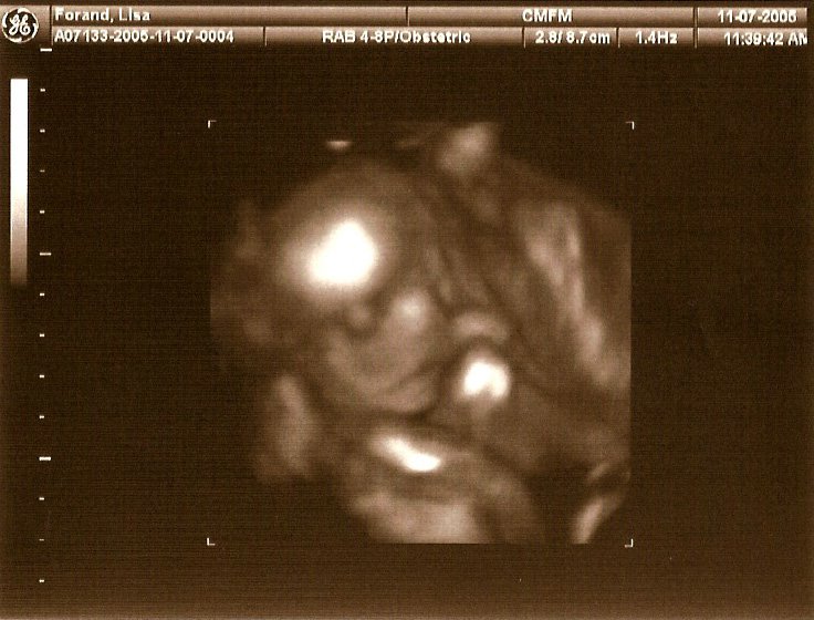 21-week sonogram 5.jpg