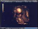 21-week sonogram 1.jpg