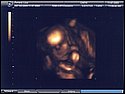 21-week sonogram 2.jpg