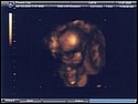 21-week sonogram 3.jpg