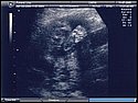 21-week sonogram 4.jpg