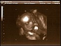 21-week sonogram 5.jpg