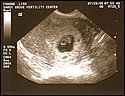 6-week sonogram.jpg