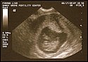 9-week sonogram.jpg